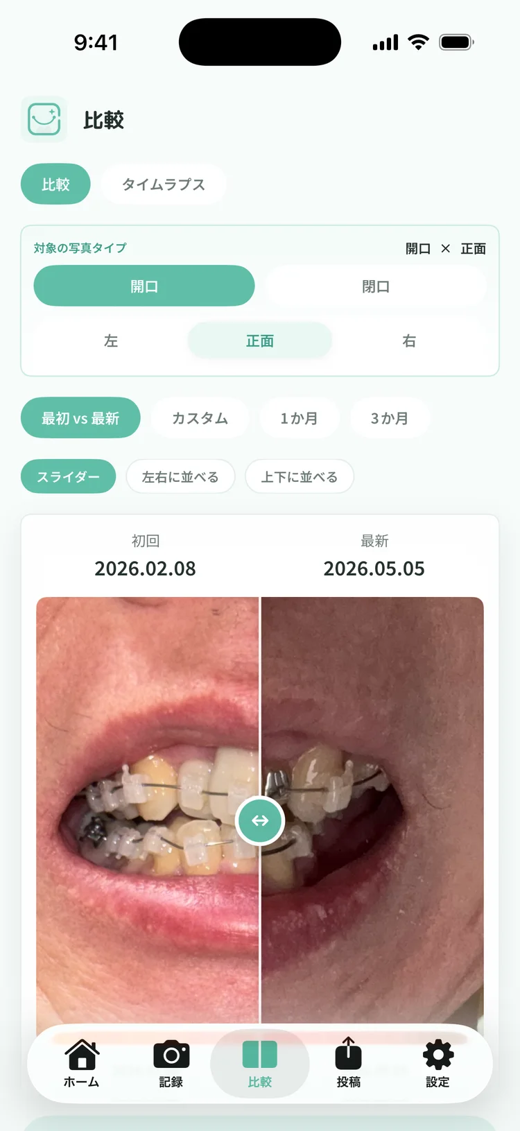 比較
